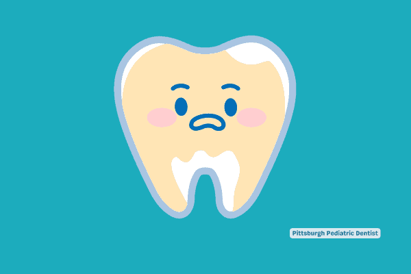 Does Coconut Oil Whiten Teeth? A Dentist’s Analysis on Oil Pulling for Teeth Whitening